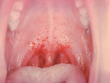 White teen deepthroat